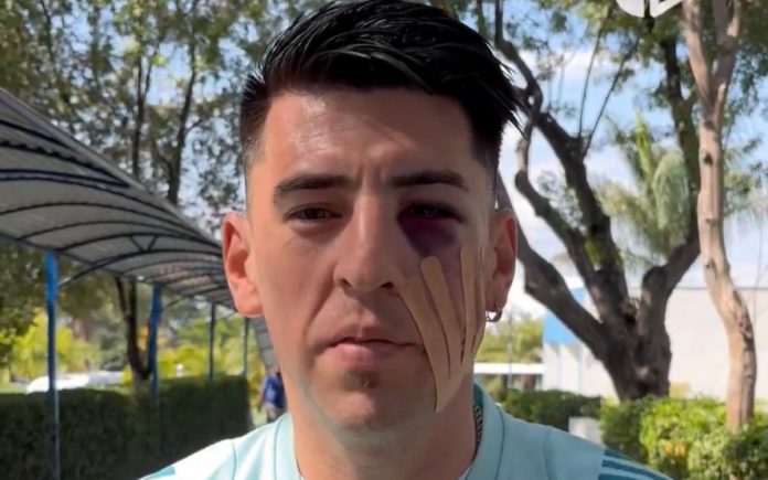 Villalba ficou com olho inchado no jogo contra o Juventude